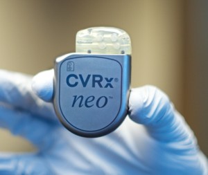 CVRx neo Implantable Stimulator for the Treatment of Hypertension