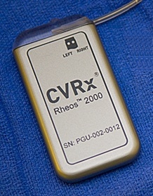 CVRx Rheos first-generation implantable baroreceptor stimulator