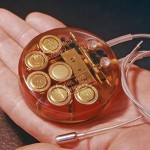 Telectronics Australia P4 Pacemaker www.implantable-device.com David Prutchi PhD