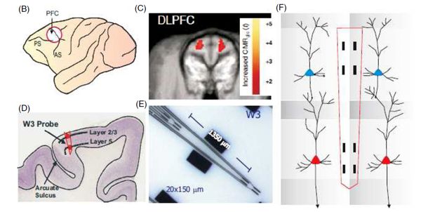 Cognitive Prosthesis www.implantable-device.com David Prutchi Ph.D.