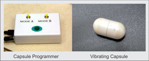 Vibrant Capsule for tretment of constipation www.implantable-device.com