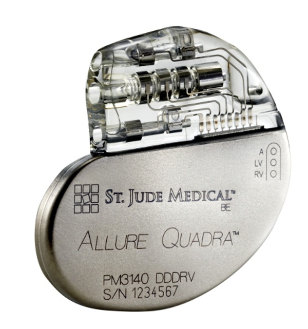 St. Jude Launches Allure Quadra™ CRT-P IPG with Quadripolar Lead Technology