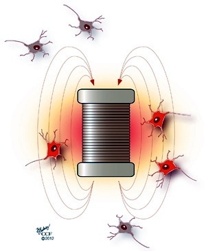 Principle of micromagnetic stimulation