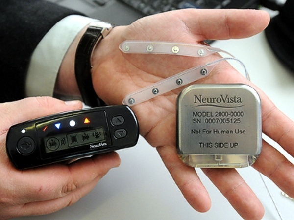 NeuroVista implantable device for seizure detection www.implantable-device.com David Prutchi PhD