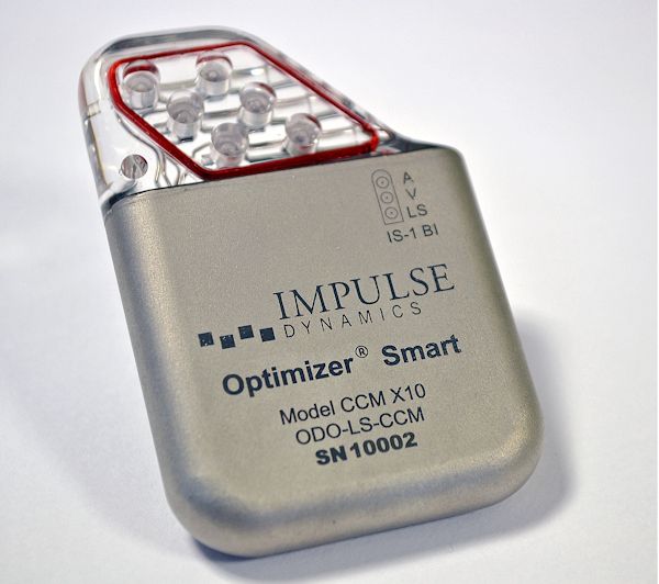 OPTIMIZER Smart IPG David Prutchi PhD