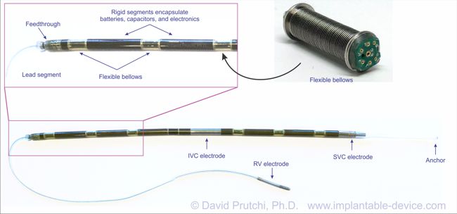 InnerPulse Percutaneous Implantable Crdioverter Defibrillator PICD (c) David Prutchi, Ph.D. www.implantable-device.com