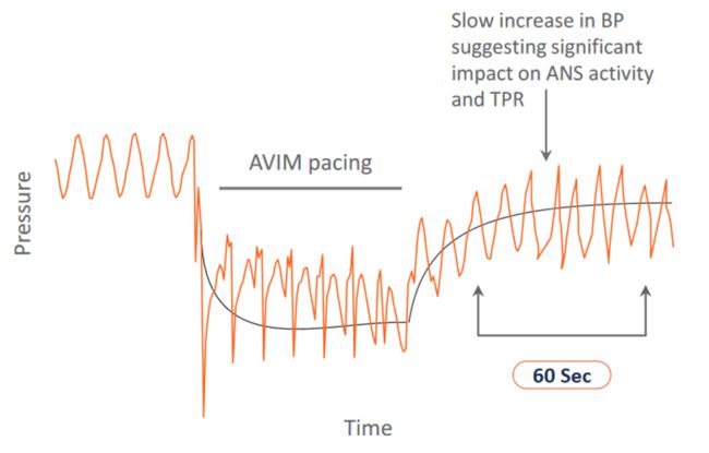 Orchestra Biomed Backbeat therapy for hypertension in patients indicated for dual-chamber pacing