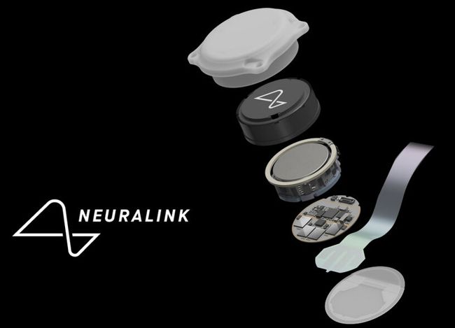 Neuralink implant