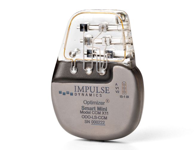 Impulse Dynamics OPTIMIZER Smart Mini IPG by Impulse Dynamics