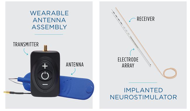 Stimwave injectable neurostimulator system