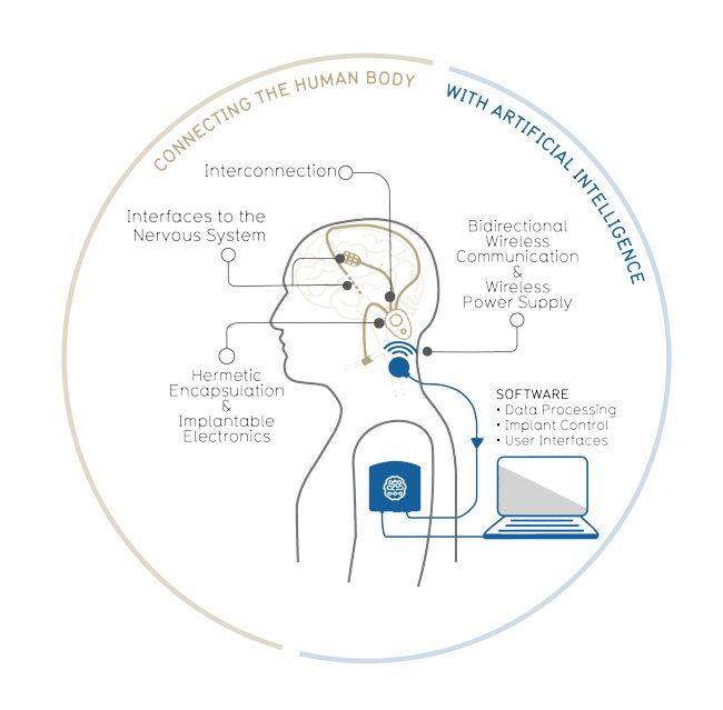 CorTec closed-loop implantable system