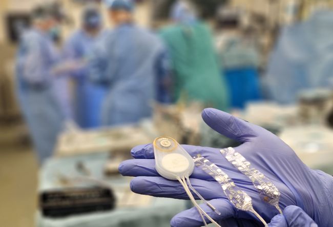 CorTec Brain Interchange Implant