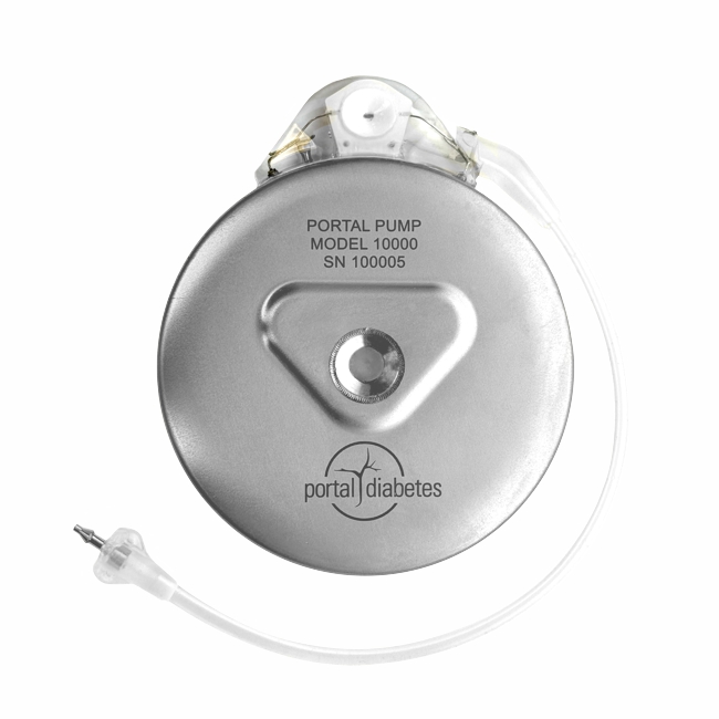 Portal Diabetes' implantable Portal Pump closed-loop artificial pancreas