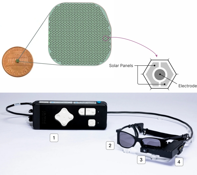 Science Corporation's PRIMA BCI device for macular degeneration