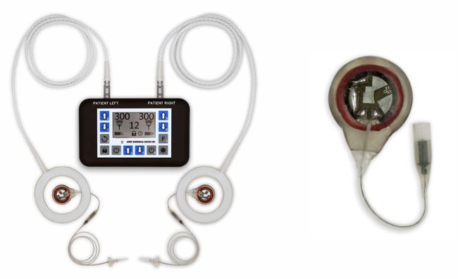 Avery Biomedical Devices Inc. phrenic nerve stimulator